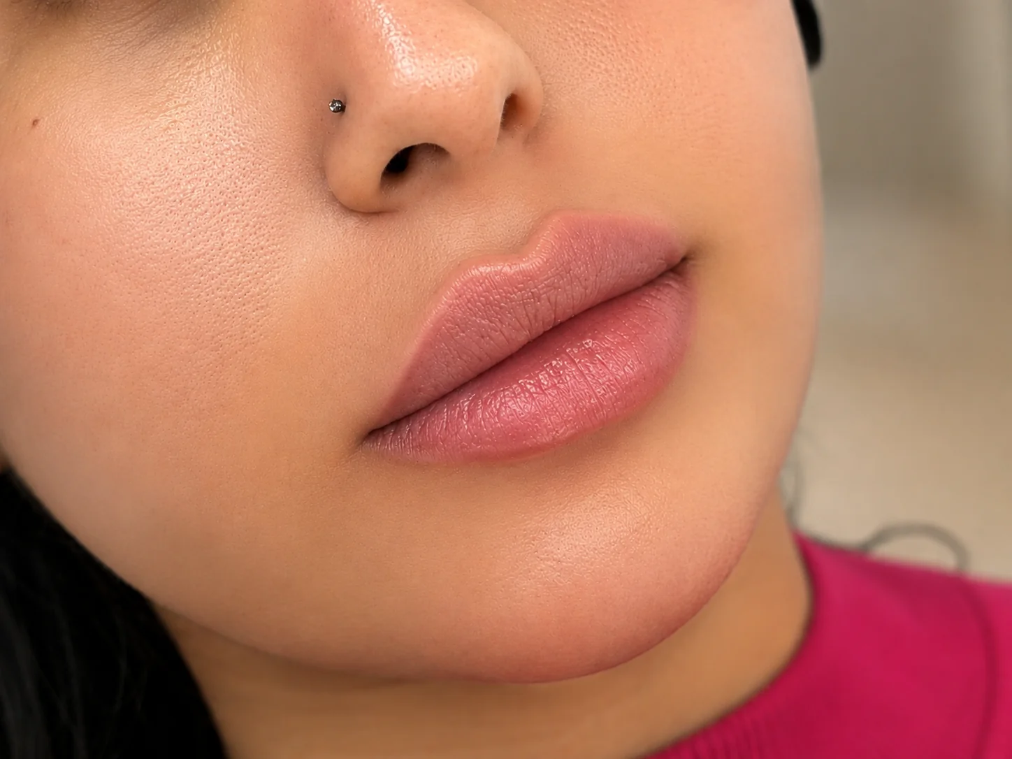 Lip Contouring and Definition โ After