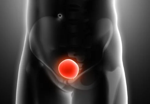Medical assessment for prostatitis at the urology clinic at Hokama Najd